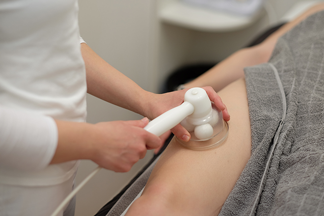 Radijalno endodermna terapija